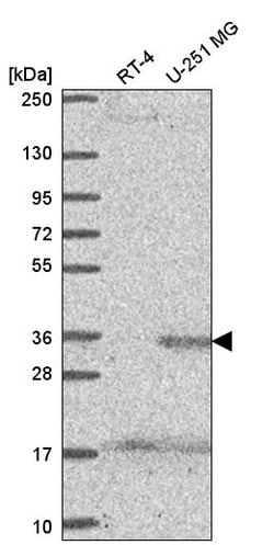 Invitrogen SPRY4 Polyclonal Antibody:Antibodies:Primary Antibodies