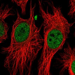 Invitrogen BAP1 Polyclonal Antibody:Antibodies, Polyclonal