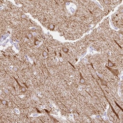 Invitrogen HEY1 Polyclonal Antibody 100 &mu;L; Unconjugated:Antibodies,