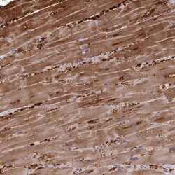 Invitrogen FABP3 Polyclonal Antibody 100 &mu;L | Buy Online | Invitrogen&trade; | Fisher Scientific