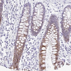 Invitrogen PIGK Polyclonal Antibody 100 &mu;L; Unconjugated:Antibodies,