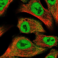 Invitrogen Protein Kinase D2 Polyclonal Antibody 100 &mu;L; Unconjugated:Antibodies,