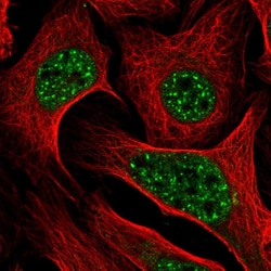 Invitrogen DLX2 Polyclonal Antibody 100 μL; Unconjugated:Antibodies,