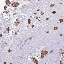 Invitrogen PIGK Polyclonal Antibody 100 &mu;L; Unconjugated:Antibodies,