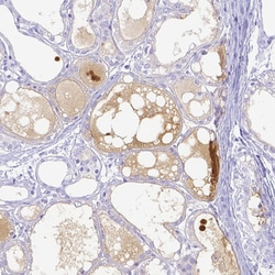 Invitrogen Lactoferrin Polyclonal Antibody 100 μL; Unconjugated:Antibodies,