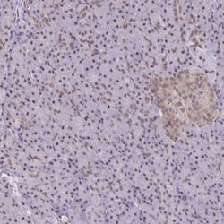 Invitrogen ING4 Polyclonal Antibody 100 μL; Unconjugated:Antibodies,