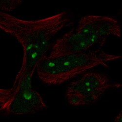 Invitrogen n-Myc Polyclonal Antibody 100 &mu;L | Buy Online | Invitrogen&trade; | Fisher Scientific