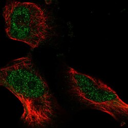 Invitrogen ATE1 Polyclonal Antibody 100 &mu;L; Unconjugated:Antibodies,