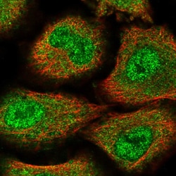 Invitrogen ZNF500 Polyclonal Antibody 100 &mu;L; Unconjugated:Antibodies,