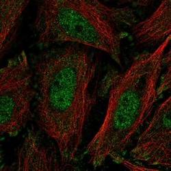Invitrogen KLF11 Polyclonal Antibody 100 μL; Unconjugated:Antibodies,