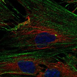 Invitrogen NPTX2 Polyclonal Antibody 100 &mu;L; Unconjugated:Antibodies,