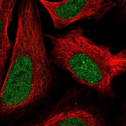 Invitrogen ZFP64 Polyclonal Antibody 100 &mu;L; Unconjugated:Antibodies,