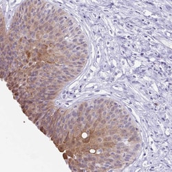 Invitrogen ZFP64 Polyclonal Antibody 100 &mu;L; Unconjugated:Antibodies,