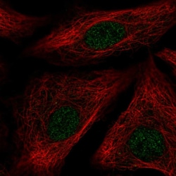 Invitrogen ID1 Polyclonal Antibody 100 &mu;L; Unconjugated:Antibodies,