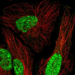 Invitrogen MEIS1 Polyclonal Antibody 100 μL; Unconjugated:Antibodies,