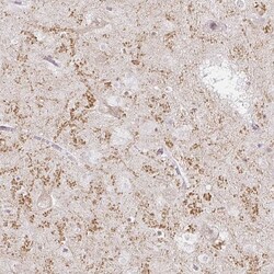 Invitrogen GluR3 Polyclonal Antibody 100 &mu;L | Buy Online | Invitrogen&trade; | Fisher Scientific