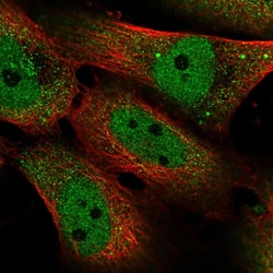 Invitrogen SMAD5 Polyclonal Antibody 100 μL; Unconjugated:Antibodies,