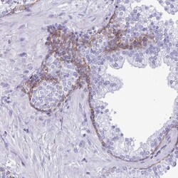 Invitrogen SMAD5 Polyclonal Antibody 100 μL; Unconjugated:Antibodies,