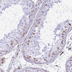 Invitrogen SMAD5 Polyclonal Antibody 100 μL; Unconjugated:Antibodies,