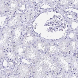 Invitrogen RUNX3 Polyclonal Antibody 100 &mu;L; Unconjugated:Antibodies,