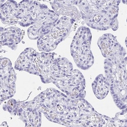 Invitrogen RUNX3 Polyclonal Antibody 100 &mu;L; Unconjugated:Antibodies,