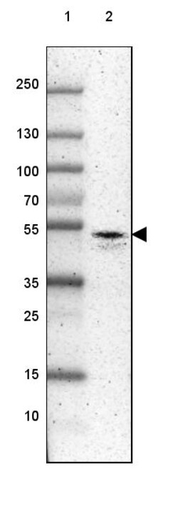 Invitrogen RUNX3 Polyclonal Antibody 100 &mu;L | Buy Online | Invitrogen&trade; | Fisher Scientific