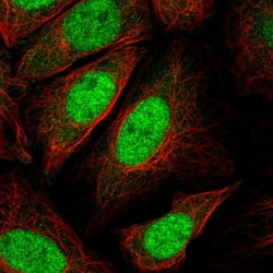 Invitrogen p27 Kip1 Polyclonal Antibody 100 μL; Unconjugated:Antibodies,