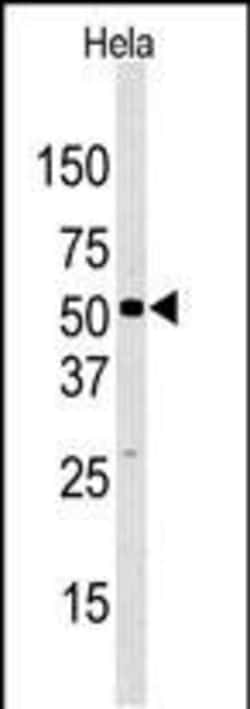 Invitrogen JMJD2D Polyclonal Antibody 400 &mu;L; Unconjugated:Antibodies,