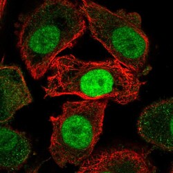 Invitrogen JMJD6 Polyclonal Antibody 100 &mu;L; Unconjugated:Antibodies,