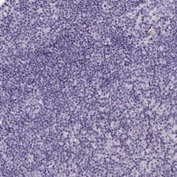 Invitrogen HOXD12 Polyclonal Antibody 100 &mu;L; Unconjugated:Antibodies,