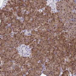 Invitrogen HOXD12 Polyclonal Antibody 100 &mu;L; Unconjugated:Antibodies,