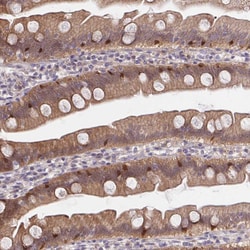 Invitrogen HOXD12 Polyclonal Antibody 100 &mu;L; Unconjugated:Antibodies,