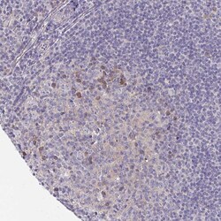 Invitrogen LTK Polyclonal Antibody 100 &mu;L; Unconjugated:Antibodies,