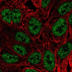 Invitrogen BATF Polyclonal Antibody 100 &mu;L; Unconjugated:Antibodies,