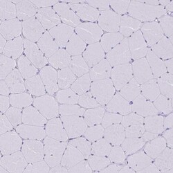 Invitrogen TLR7 Polyclonal Antibody 100 &mu;L; Unconjugated:Antikörper