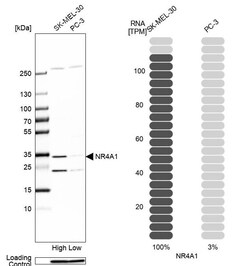 Invitrogen NR4A1 Polyclonal Antibody 100 &mu;L; Unconjugated:Antibodies,