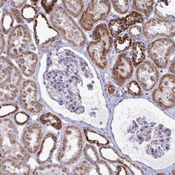 Invitrogen OR10R2 Polyclonal Antibody 100 &mu;L; Unconjugated:Antibodies,