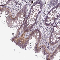 Invitrogen MST4 Polyclonal Antibody 100 &mu;L; Unconjugated:Antibodies,