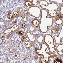 Invitrogen Lactoferrin Polyclonal Antibody 100 μL; Unconjugated:Antibodies,