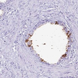 Invitrogen Lactoferrin Polyclonal Antibody 100 μL; Unconjugated:Antibodies,