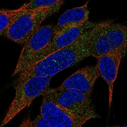 Invitrogen REG3A Polyclonal Antibody 100 &mu;L; Unconjugated:Antibodies,