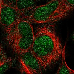 Invitrogen IMP3 Polyclonal Antibody 100 &mu;L; Unconjugated:Antibodies,