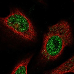 Invitrogen FEM1C Polyclonal Antibody 100 &mu;L; Unconjugated:Antibodies,