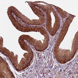 Invitrogen FAM21A Polyclonal Antibody 100 &mu;L; Unconjugated:Antibodies,