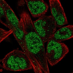Invitrogen EBF1 Polyclonal Antibody 100 &mu;L; Unconjugated:Antibodies,