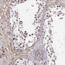 Invitrogen CIR1 Polyclonal Antibody 100 μL; Unconjugated:Antibodies,