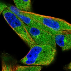 Invitrogen JLP Polyclonal Antibody 100 &mu;L; Unconjugated:Antibodies,