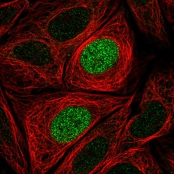 Invitrogen PHLDB1 Polyclonal Antibody 100 &mu;L; Unconjugated:Antibodies,