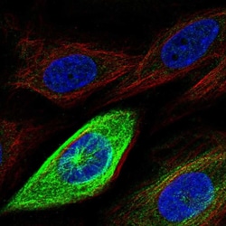 RHAMM Polyclonal Antibody:Antibodies, Polyclonal