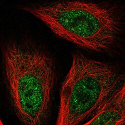 Invitrogen GSTCD Polyclonal Antibody 100 &mu;L; Unconjugated:Antibodies,